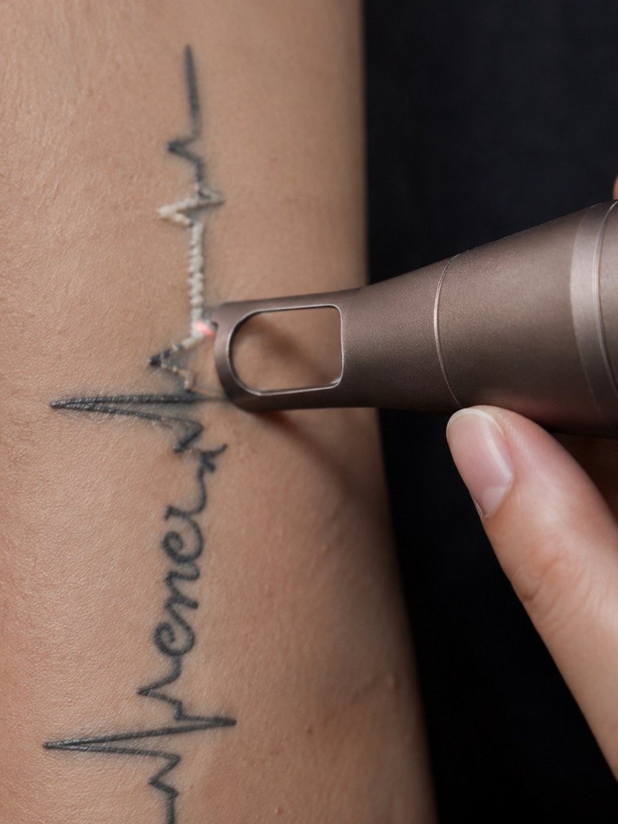 Laser Tattoo & Permanent Makeup Removal