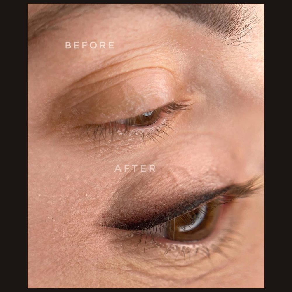 Shadow liner on the eyelids — before and right after the procedure